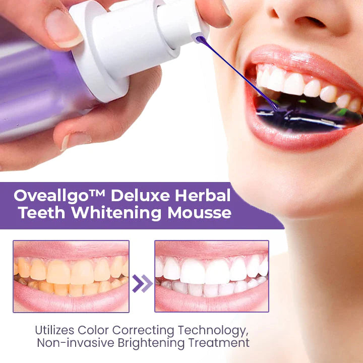 Idol™ PRO Deluxe Herbal Teeth Whitening