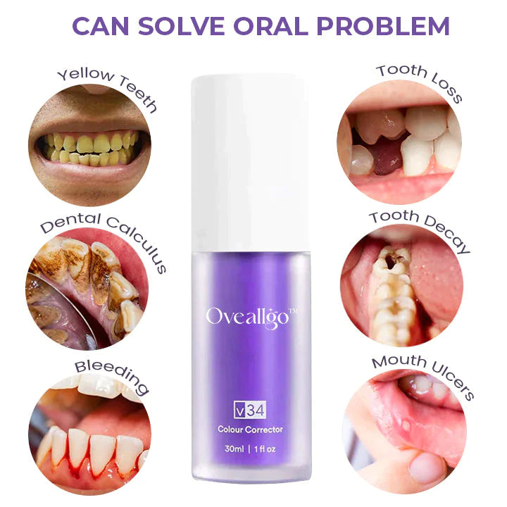 Idol™ PRO Deluxe Herbal Teeth Whitening