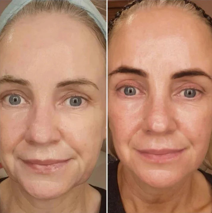 WomenIdol Toning Device