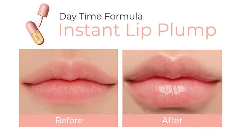 Women Idol LipFillers